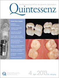Quintessenz Zahnmedizin, 4/2013