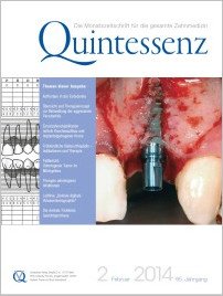 Quintessenz Zahnmedizin, 2/2014