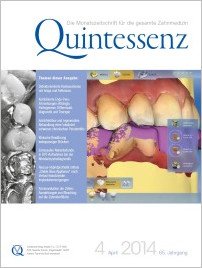 Quintessenz Zahnmedizin, 4/2014