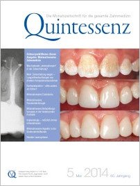 Quintessenz Zahnmedizin, 5/2014