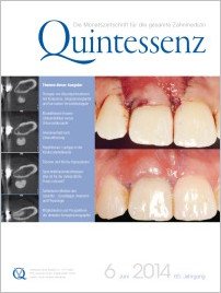 Quintessenz Zahnmedizin, 6/2014
