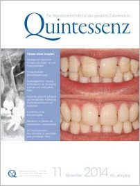 Quintessenz Zahnmedizin, 11/2014
