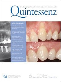 Quintessenz Zahnmedizin, 6/2015