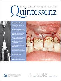 Quintessenz Zahnmedizin, 4/2016