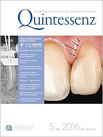 Quintessenz Zahnmedizin, 5/2016