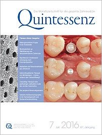 Quintessenz Zahnmedizin, 7/2016