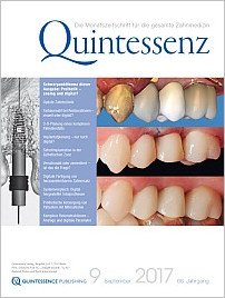 Quintessenz Zahnmedizin, 9/2017