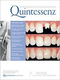 Quintessenz Zahnmedizin, 7/2018