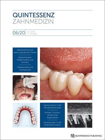 Quintessenz Zahnmedizin, 6/2020