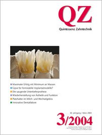 QZ - Quintessenz Zahntechnik, 3/2004