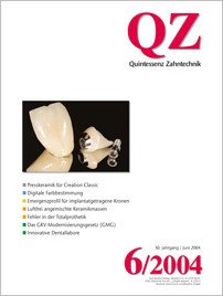 QZ - Quintessenz Zahntechnik, 6/2004