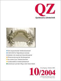 QZ - Quintessenz Zahntechnik, 10/2004