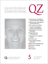 QZ - Quintessenz Zahntechnik, 5/2013
