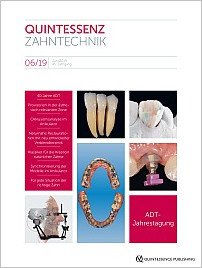 QZ - Quintessenz Zahntechnik, 6/2019