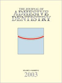 The Journal of Adhesive Dentistry, 2/2003