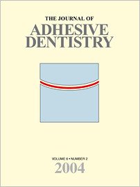 The Journal of Adhesive Dentistry, 2/2004