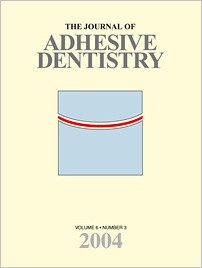 The Journal of Adhesive Dentistry, 3/2004