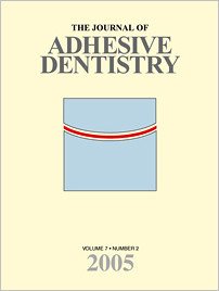 The Journal of Adhesive Dentistry, 2/2005
