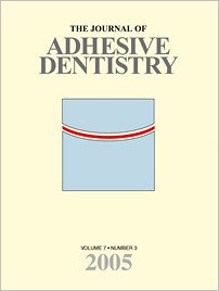 The Journal of Adhesive Dentistry, 3/2005
