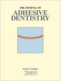 The Journal of Adhesive Dentistry, 4/2005