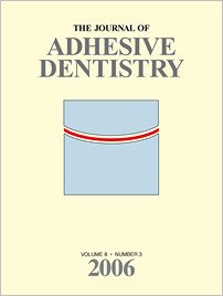 The Journal of Adhesive Dentistry, 3/2006