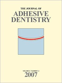 The Journal of Adhesive Dentistry, 2/2007