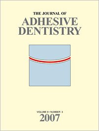 The Journal of Adhesive Dentistry, 3/2007
