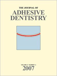 The Journal of Adhesive Dentistry, 5/2007