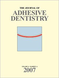 The Journal of Adhesive Dentistry, 6/2007