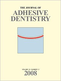 The Journal of Adhesive Dentistry, 2/2008