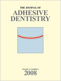 The Journal of Adhesive Dentistry, 3/2008