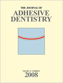 The Journal of Adhesive Dentistry, 5/2008