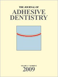 The Journal of Adhesive Dentistry, 2/2009