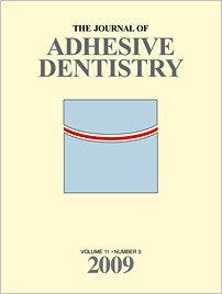 The Journal of Adhesive Dentistry, 3/2009