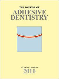 The Journal of Adhesive Dentistry, 3/2010