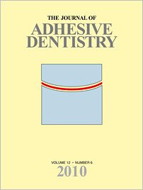 The Journal of Adhesive Dentistry, 6/2010