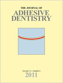 The Journal of Adhesive Dentistry, 2/2011