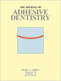 The Journal of Adhesive Dentistry, 2/2012