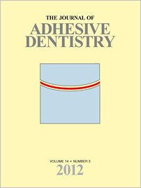 The Journal of Adhesive Dentistry, 3/2012