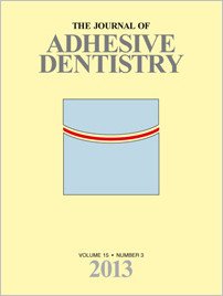 The Journal of Adhesive Dentistry, 3/2013