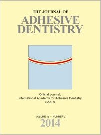 The Journal of Adhesive Dentistry, 2/2014