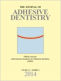 The Journal of Adhesive Dentistry, 3/2014