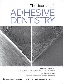 The Journal of Adhesive Dentistry, 2/2017
