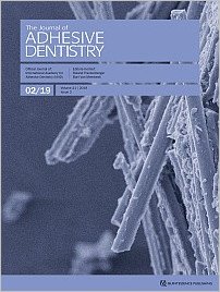 The Journal of Adhesive Dentistry, 2/2019