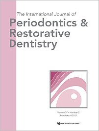International Journal of Periodontics & Restorative Dentistry, 2/2017