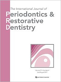 International Journal of Periodontics & Restorative Dentistry, 4/2017