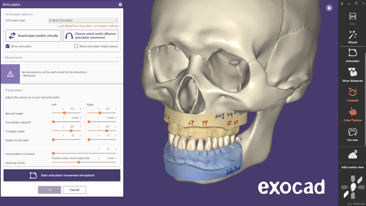 Der neue Virtuelle Artikulator unterstützt Gamma Dental Reference SL, Kavo Protarevo 5B sowie die Artikulatorvisualisierung in einem anatomischen Schädelmodell.