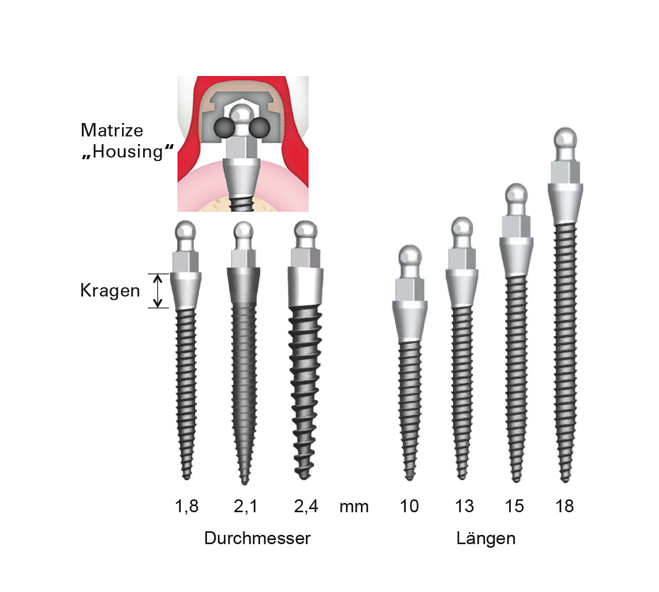 Abb. 1 Beispiel für ein Miniimplantat- System: Mini Dental Implants (MDI). 