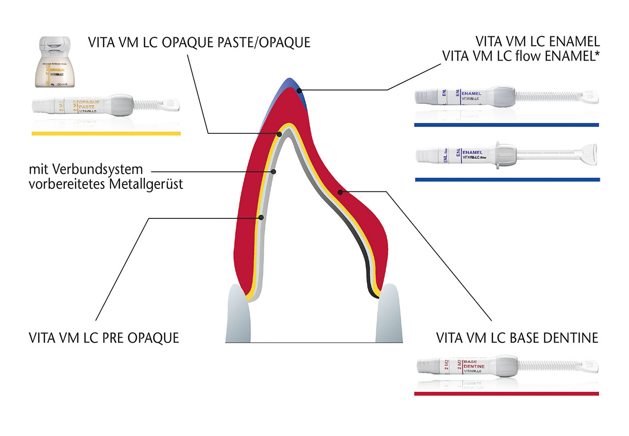 Abb. 5a Die VITA VM LC BASIC-Schichtung setzt sich nach dem Auftrag des Verbundsystems PRE OPAQUE, OPAQUE/OPAQUE PASTE aus BASE DENTINE und ENAMEL/flow ENAMEL zusammen.