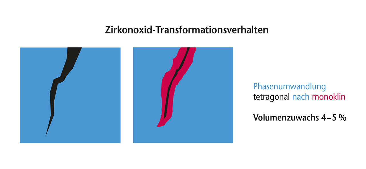 Abb. 6 Die Phasenumwandlung von Zirkonoxid an den Rissflanken.